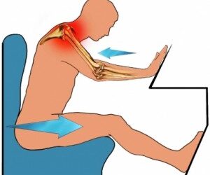 Typical Injuries Resulting from Car and Motor Vehicle Accidents